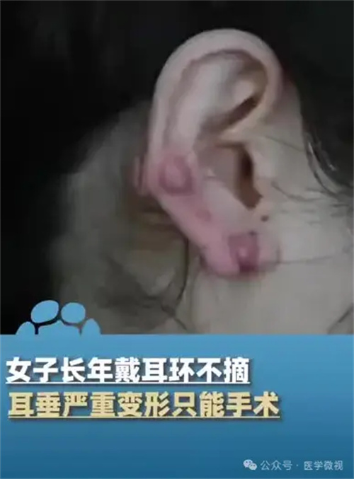 图片细节说明